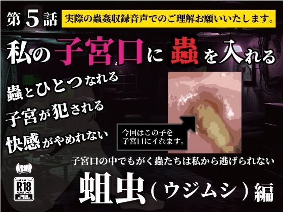 私の子宮口の中に蟲を入れる 第5話 蛆虫（ウジムシ）編 今夜のオカズに！！